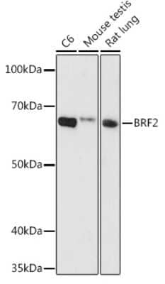 Western Blot: BRF2 AntibodyAzide and BSA Free [NBP2-92838]